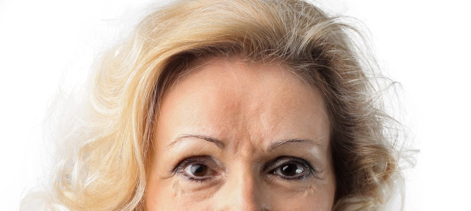Anti Wrinkle Injections Melbourne CBD